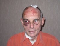 burglary2