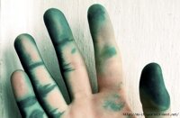 A literal interpretation of "green fingers" 